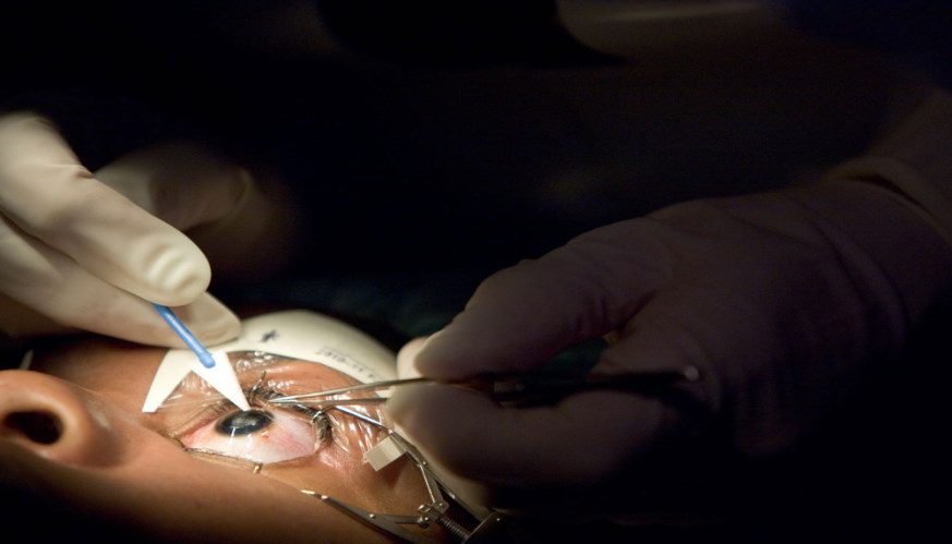5 Reasons That You Should Not Retain Fears Of Laser Eye Surgery